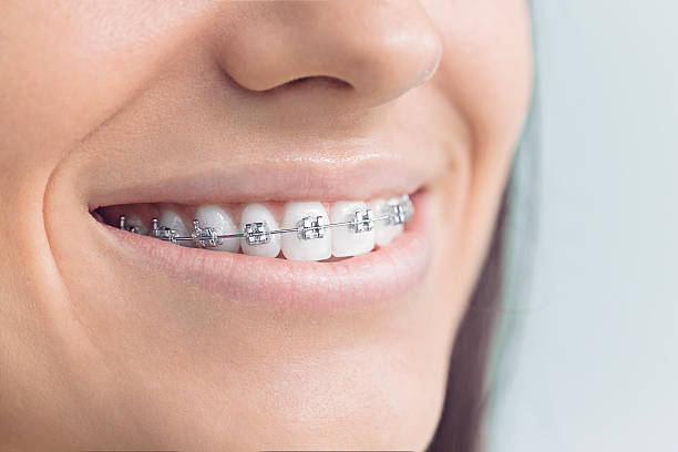Best Dental Inlays and Onlays  in East Lake, FL